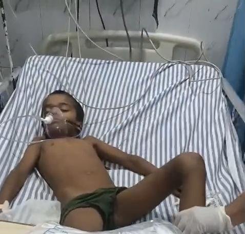 An 8-year-old boy was seriously injured after falling from a jamun tree while picking fruit in Rihawali village of Fatehabad, Agra.